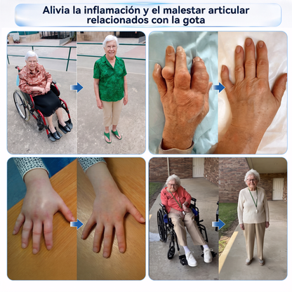 ✨👌𝗜𝑭𝑴𝑨𝑮𝑰𝐶® 𝑨𝒍𝒑𝒊𝒏𝒆 𝑩𝒐𝒕𝒂𝒏𝒊𝒄𝒂𝒍 𝑷𝒂𝒓𝒄𝒉𝒆 𝑫𝒆 𝑴𝒊𝒄𝒓𝒐𝒂𝒈𝒖𝒋𝒂𝒔 𝑷𝒂𝒓𝒂 𝑨𝒓𝒕𝒊𝒄𝒖𝒍𝒂𝒄𝒊𝒐𝒏𝒆𝒔💎
