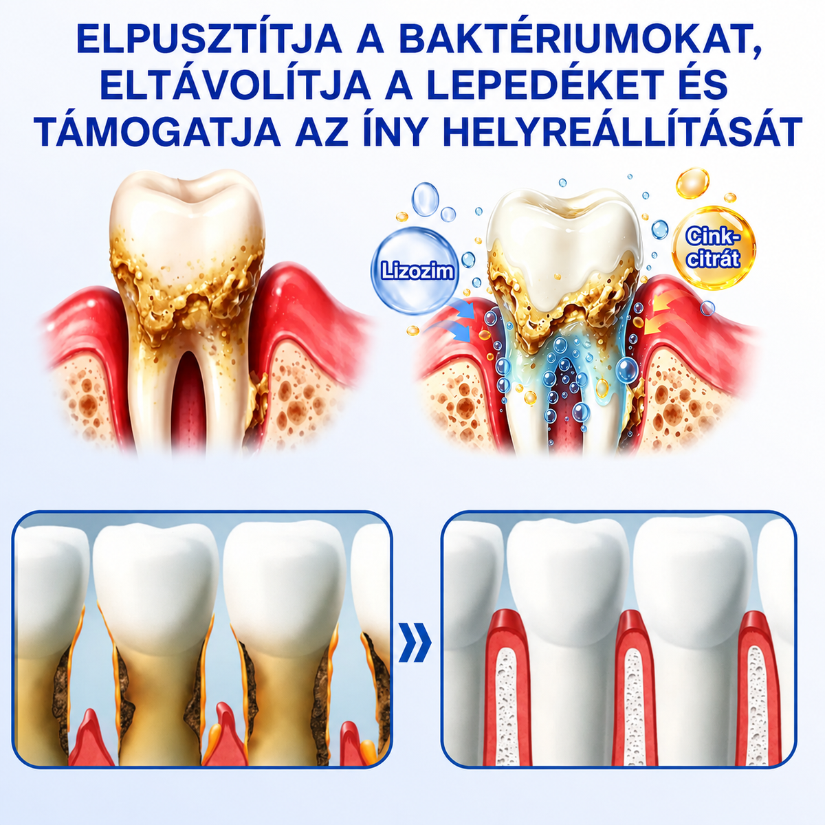 👨‍⚕️🦷✨Evolvion® GumRevive fogágyregeneráló gél