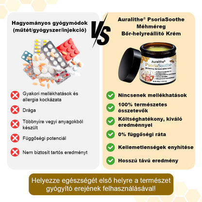 🐝 Auralithe® PsoriaSoothe – Szteroidmentes méhméreges krém viszkető, hámló és érzékeny bőrre ⭐⭐