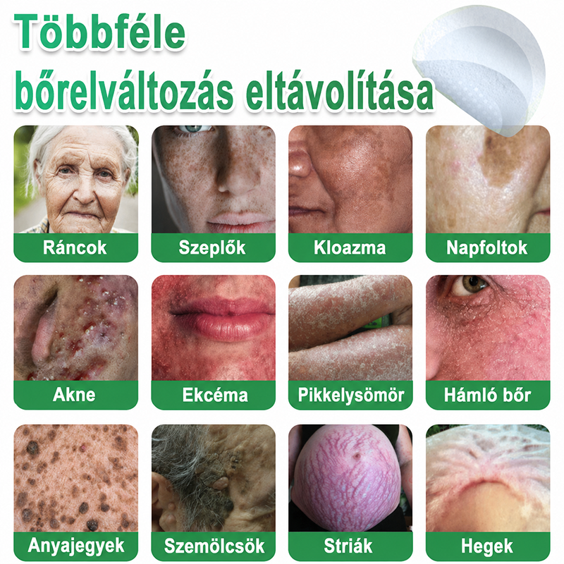 👉Hudros® 😜 2-az-1-ben Mikrotű & Hidrokoloid Tapasz | Kiemelkedő Anyajegyek, Pattanások, Lapos Szemölcsök & Bőrkinövések Eltávolítója | Ráncok, Hegek & Bőrhibák Javítása | Láthatatlan Csillag Pattanástapasz Arcra & Testre | 144 db