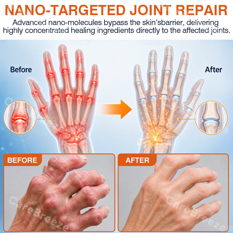 👨‍⚕️✅🇨🇦 Official Store:  CareBreeze® Pain-Relief Bone-Healing Microneedle Patch(🧑‍⚕️Reducing joint swelling, pain, stiffness, redness, warmth, soreness, and joint fatigue)