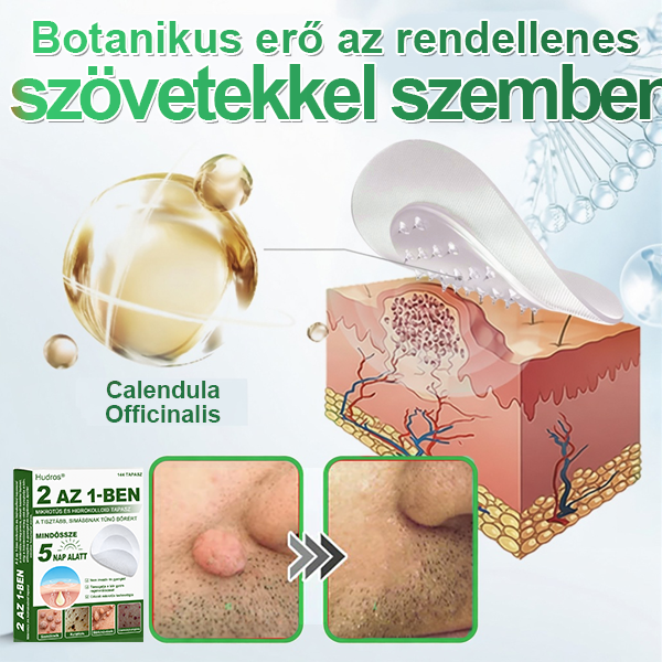 👉Hudros® 😜 2-az-1-ben Mikrotű & Hidrokoloid Tapasz | Kiemelkedő Anyajegyek, Pattanások, Lapos Szemölcsök & Bőrkinövések Eltávolítója | Ráncok, Hegek & Bőrhibák Javítása | Láthatatlan Csillag Pattanástapasz Arcra & Testre | 144 db