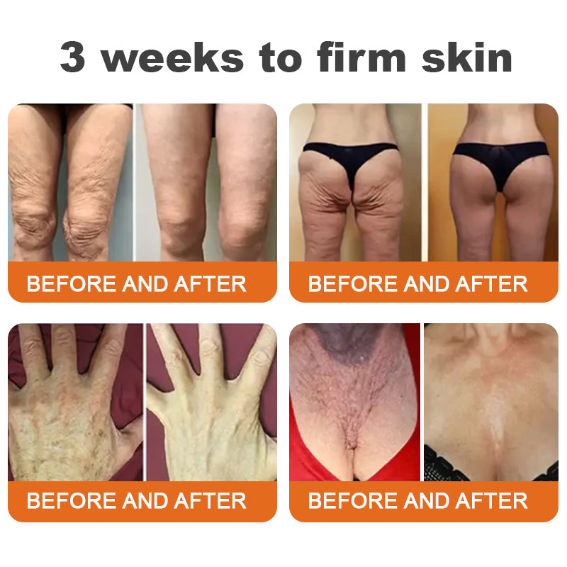 🔥✨ Flysmus™ Botoks Jad pszczeli Serum ujędrniające w sztyfcie🔥OSTATNI DZIEŃ 70% ZNIŻKI