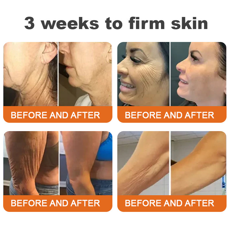 🔥✨ Flysmus™ Botoks Jad pszczeli Serum ujędrniające w sztyfcie🔥OSTATNI DZIEŃ 70% ZNIŻKI