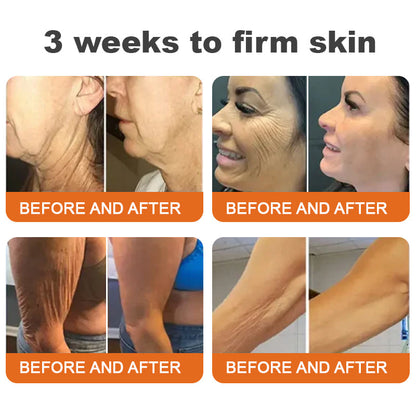 🔥✨ Flysmus™ Botoks Jad pszczeli Serum ujędrniające w sztyfcie🔥OSTATNI DZIEŃ 70% ZNIŻKI