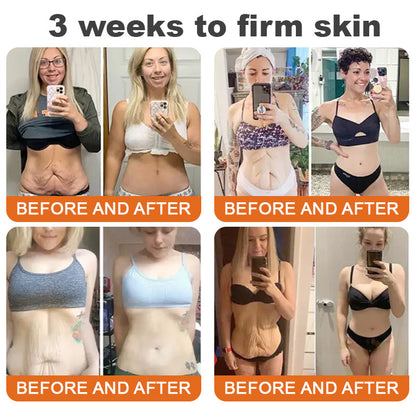 🔥✨ Flysmus™ Botoks Jad pszczeli Serum ujędrniające w sztyfcie🔥OSTATNI DZIEŃ 70% ZNIŻKI