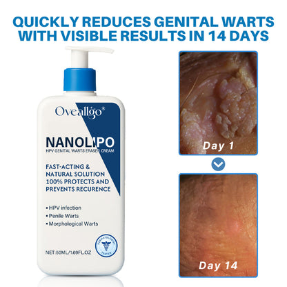 Oveallgo® NanoLipo HPV Genital Warts Eraser Cream Plus+