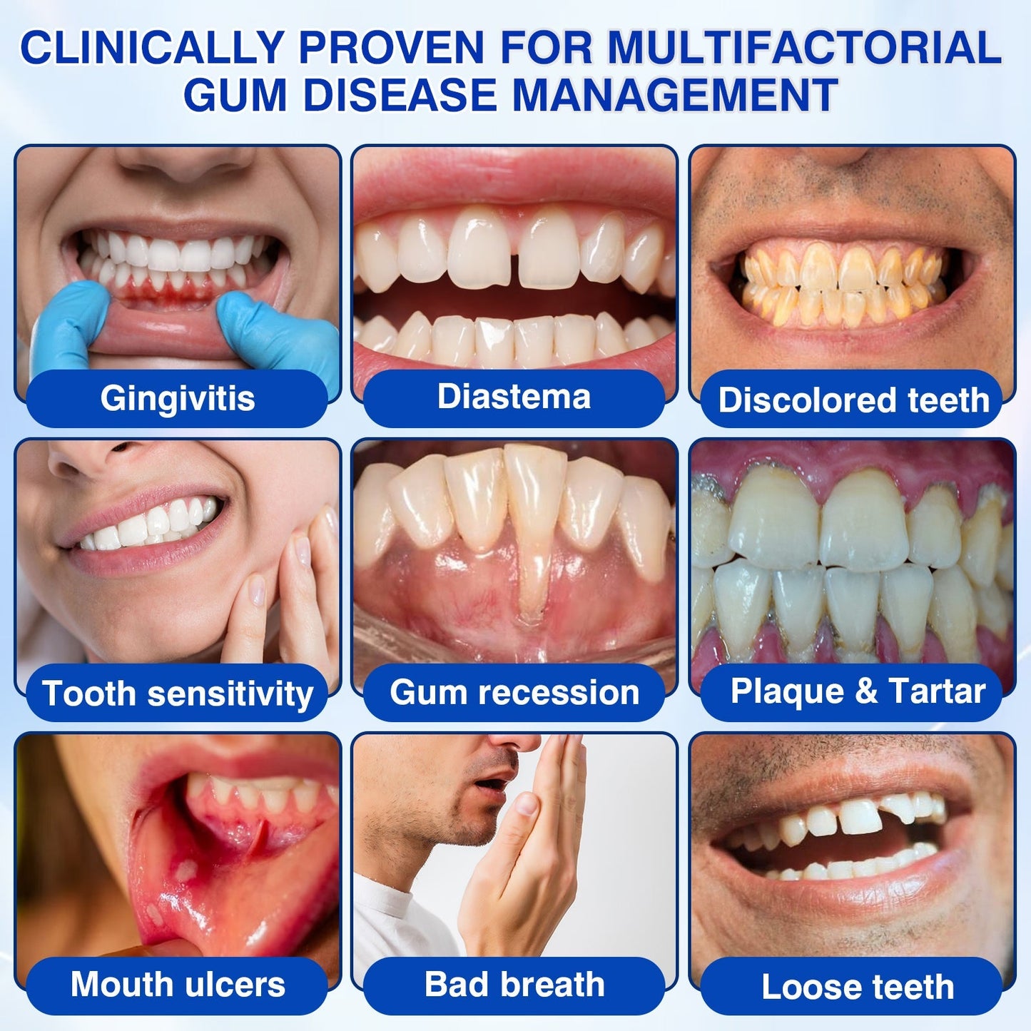 👨‍⚕️🦷✨Evolvion® GumRevive fogágyregeneráló gél