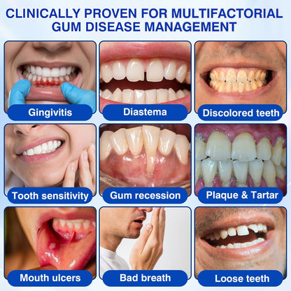👨‍⚕️🦷✨Evolvion® GumRevive fogágyregeneráló gél