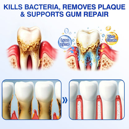 👨‍⚕️🦷✨Evolvion® GumRevive fogágyregeneráló gél