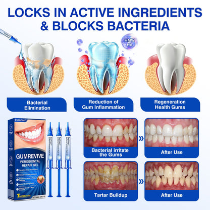 👨‍⚕️🦷✨Evolvion® GumRevive fogágyregeneráló gél
