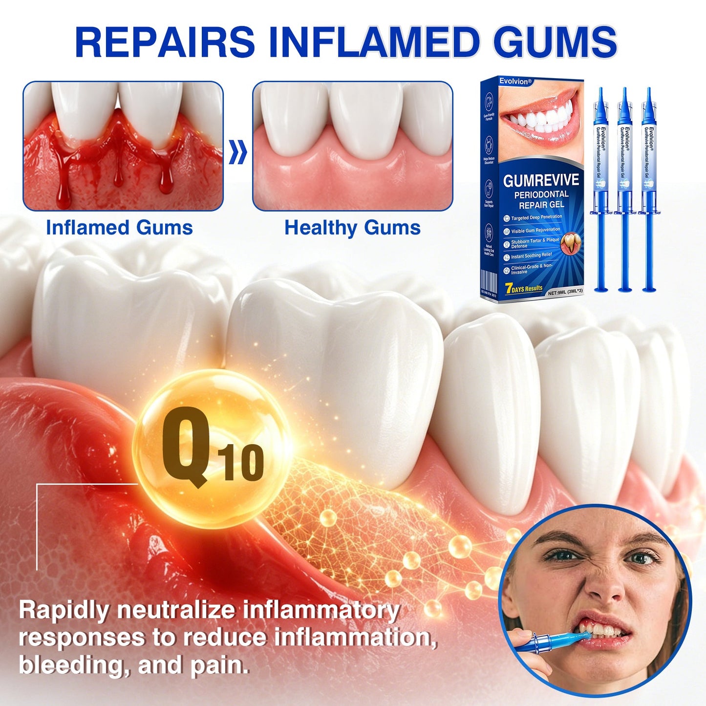 👨‍⚕️🦷✨Evolvion® GumRevive fogágyregeneráló gél