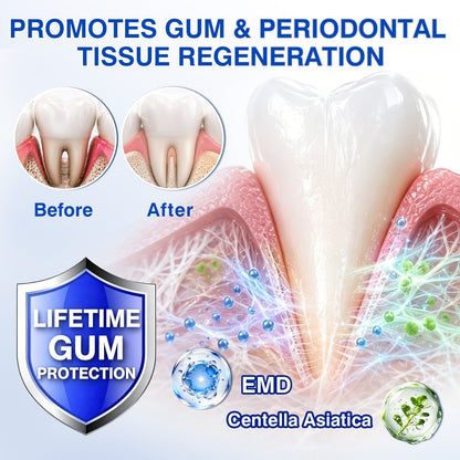 👨‍⚕️🦷✨Evolvion® GumRevive fogágyregeneráló gél