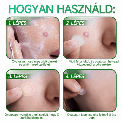 👉Hudros® 😜 2-az-1-ben Mikrotű & Hidrokoloid Tapasz | Kiemelkedő Anyajegyek, Pattanások, Lapos Szemölcsök & Bőrkinövések Eltávolítója | Ráncok, Hegek & Bőrhibák Javítása | Láthatatlan Csillag Pattanástapasz Arcra & Testre | 144 db