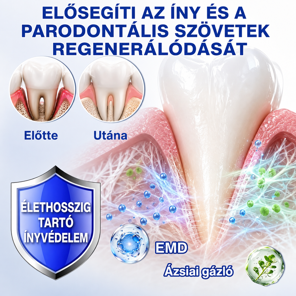 👨‍⚕️🦷✨Evolvion® GumRevive fogágyregeneráló gél