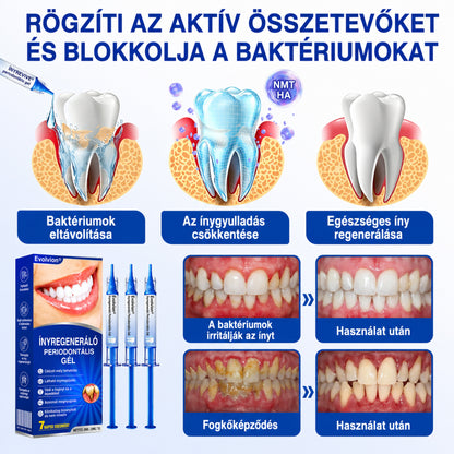 👨‍⚕️🦷✨Evolvion® GumRevive fogágyregeneráló gél