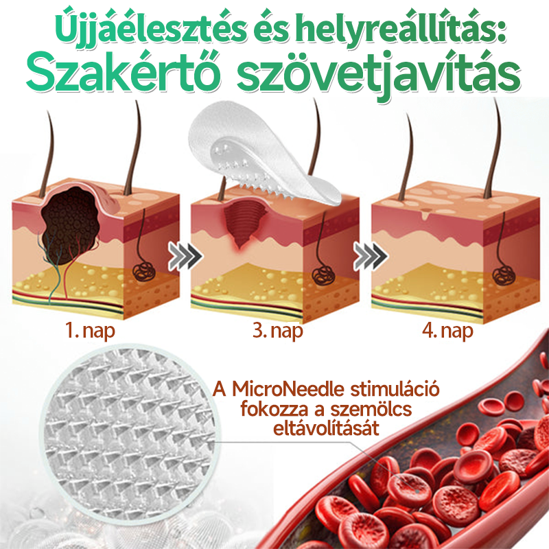 👉Hudros® 😜 2-az-1-ben Mikrotű & Hidrokoloid Tapasz | Kiemelkedő Anyajegyek, Pattanások, Lapos Szemölcsök & Bőrkinövések Eltávolítója | Ráncok, Hegek & Bőrhibák Javítása | Láthatatlan Csillag Pattanástapasz Arcra & Testre | 144 db