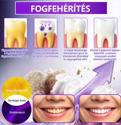 𝐷𝑜𝒓𝒎𝒐𝒓𝑛𝑎® Fogregeneráló és -javító por hidroxiapatittal 🦷 (hatékonyan javítja a fogszuvasodást, az ínyproblémákat, a fogak túlérzékenységét, a szájfekélyeket és a fogak sárgulását, átfogóan javítva a szájhigiéniát) 🍀