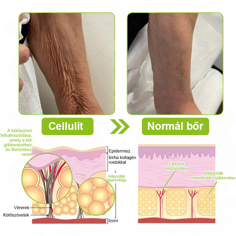 ✨ Vosxu™ Botox & Vita-A Retinol Shot ráncfelvarró szérum ✨ – 💉 Mikro-tűk | 💪 Botox-szerű peptidek | 🌿 Retinol | ⚡ Látható eredmények már 3 nap alatt 🌸