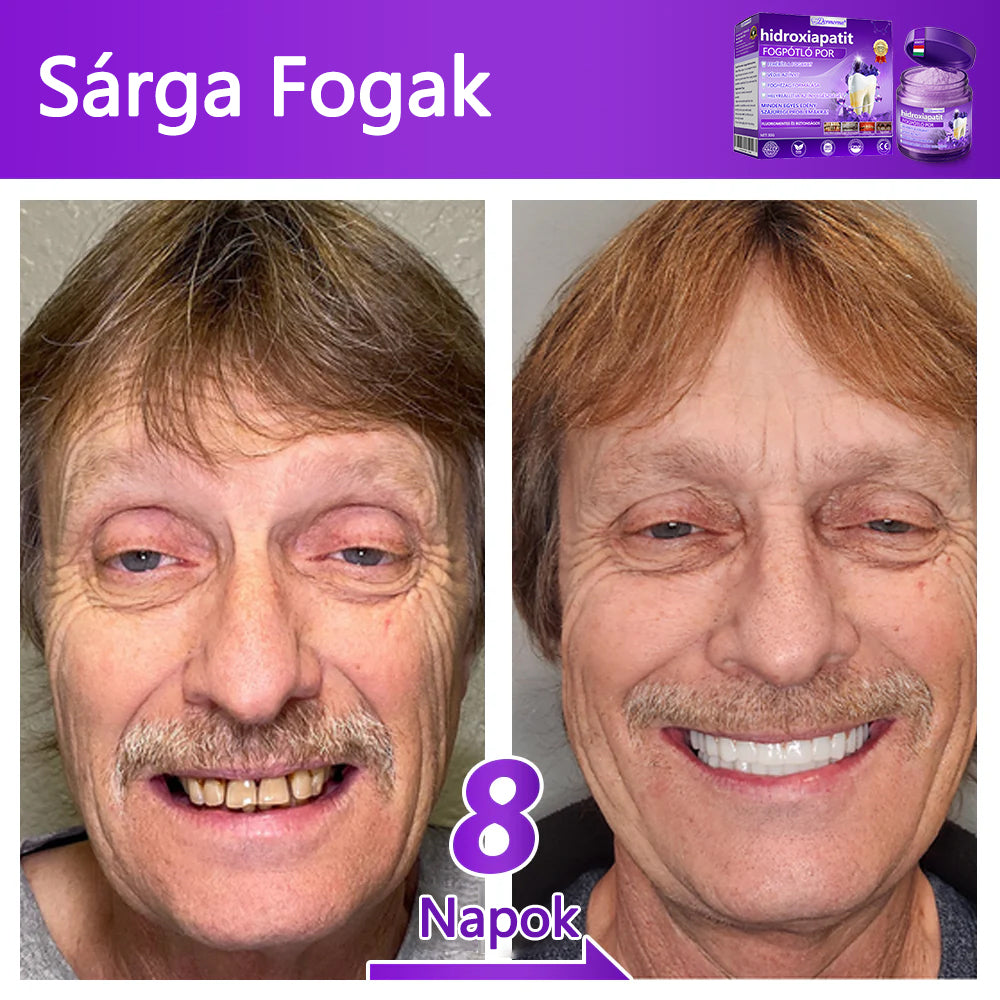 𝐷𝑜𝒓𝒎𝒐𝒓𝑛𝑎® Fogregeneráló és -javító por hidroxiapatittal 🦷 (hatékonyan javítja a fogszuvasodást, az ínyproblémákat, a fogak túlérzékenységét, a szájfekélyeket és a fogak sárgulását, átfogóan javítva a szájhigiéniát) 🍀