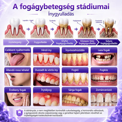 CleraNaure® Ínygyulladás és Fogágyproblémák Kezelésére Szolgáló Fogkrém👑