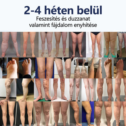 Tivora®✨ SwellRelief keringést támogató krém