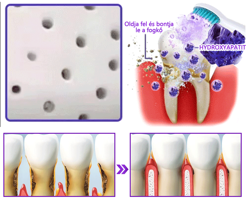 𝐷𝑜𝒓𝒎𝒐𝒓𝑛𝑎® Fogregeneráló és -javító por hidroxiapatittal 🦷 (hatékonyan javítja a fogszuvasodást, az ínyproblémákat, a fogak túlérzékenységét, a szájfekélyeket és a fogak sárgulását, átfogóan javítva a szájhigiéniát) 🍀