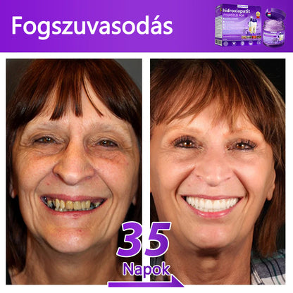 𝐷𝑜𝒓𝒎𝒐𝒓𝑛𝑎® Fogregeneráló és -javító por hidroxiapatittal 🦷 (hatékonyan javítja a fogszuvasodást, az ínyproblémákat, a fogak túlérzékenységét, a szájfekélyeket és a fogak sárgulását, átfogóan javítva a szájhigiéniát) 🍀