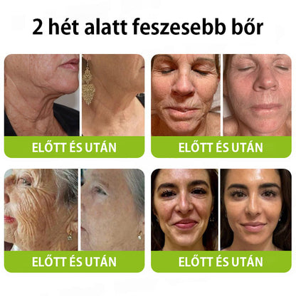 ✨ Vosxu™ Botox & Vita-A Retinol Shot ráncfelvarró szérum ✨ – 💉 Mikro-tűk | 💪 Botox-szerű peptidek | 🌿 Retinol | ⚡ Látható eredmények már 3 nap alatt 🌸