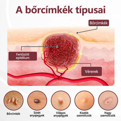 🔥🔥Broxie® KeraErase kettős hatású megújító krém