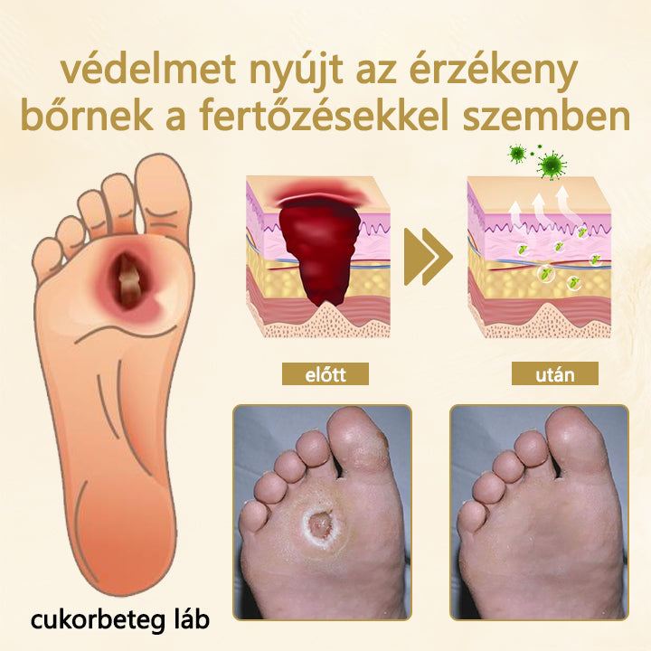 🔥Cvreoz® méhméreg gyógyító spray a sebek gyógyulására és regenerálására a kezeken és a lábakon🎉