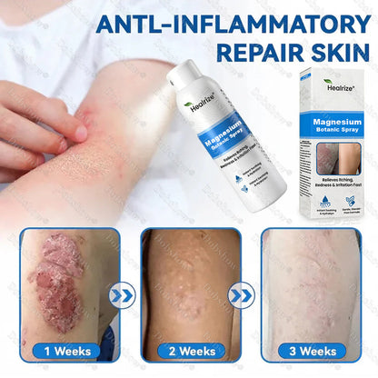 🔥Healrize® Magnesium Botanic Spray – Advanced Skin Recovery for Psoriasis & Eczema | Rapid Soothing, Steroid-Free