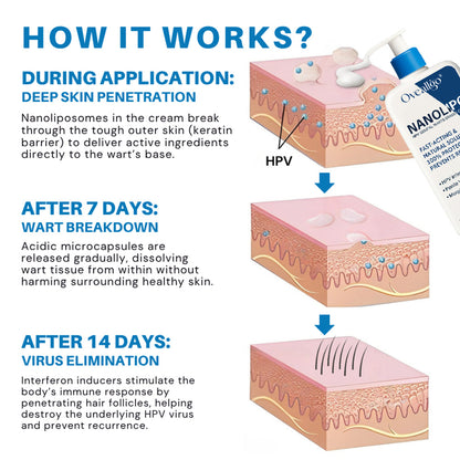 Oveallgo® NanoLipo HPV Genital Warts Eraser Cream Plus+