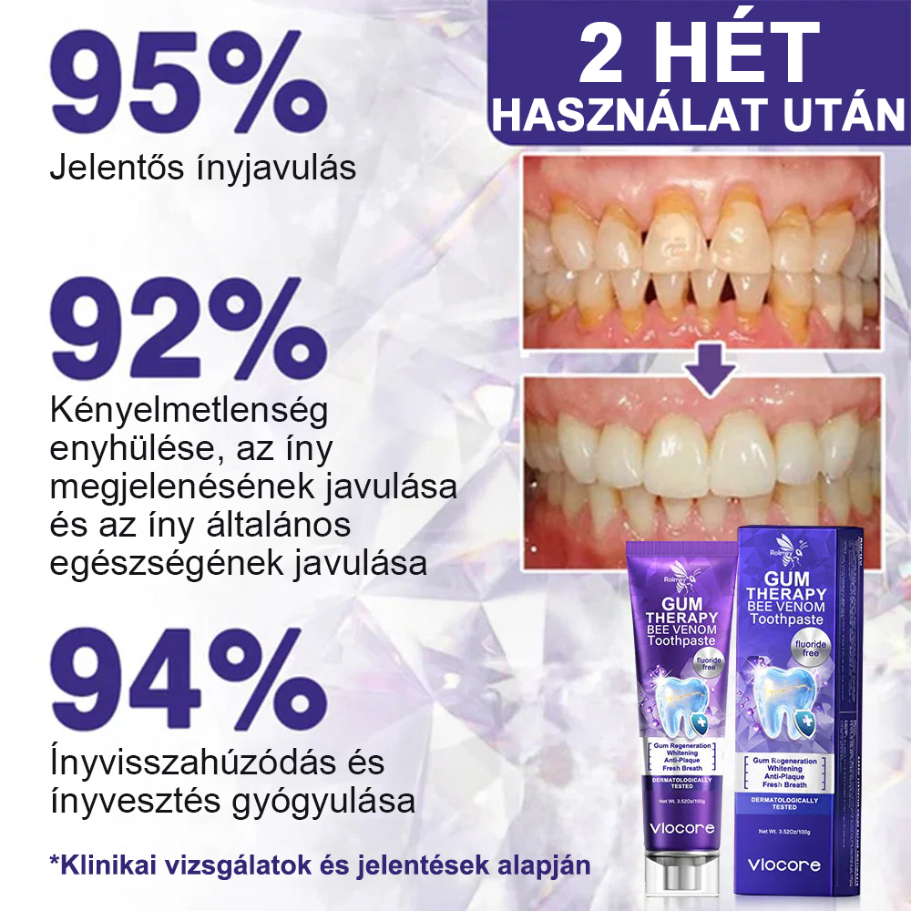 🌟Rolimey® VioCore Méhméreg Fogkezelő Fogkrém📦