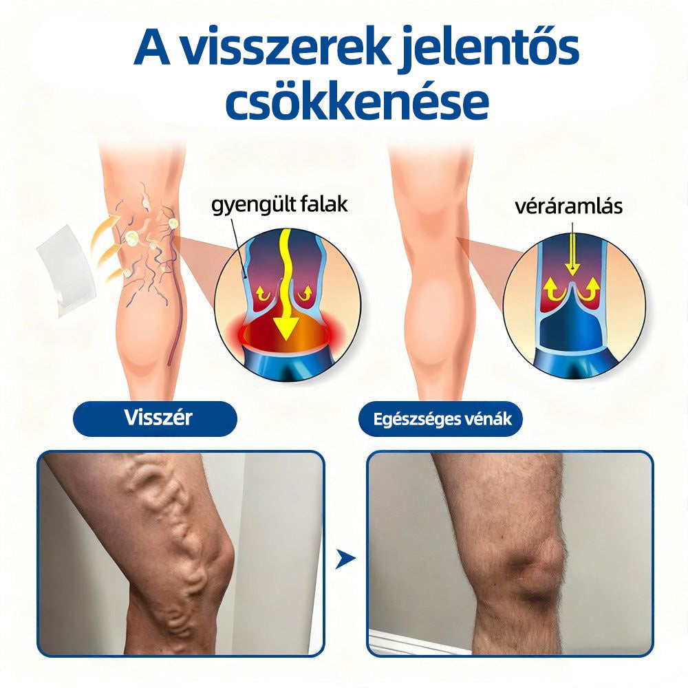 🇭🇺𝐇𝐞𝐚𝐥𝐫𝐢𝐳𝐞® 👩‍⚕️👩‍⚕️VeinTarget mikrotűs tapasz⚡☑️Azonnali enyhülés hosszú távú eredmények
