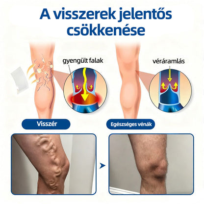 🇭🇺𝐇𝐞𝐚𝐥𝐫𝐢𝐳𝐞® 👩‍⚕️👩‍⚕️VeinTarget mikrotűs tapasz⚡☑️Azonnali enyhülés hosszú távú eredmények