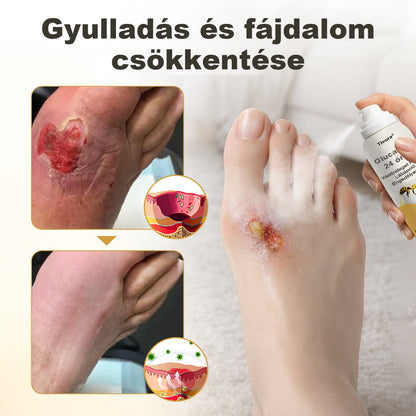 Tivora® GlucaVeil 24 órás Védőréteget Képző Lábápoló Permet⭐️