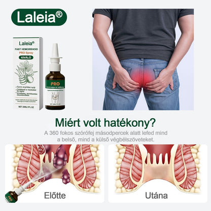 Újévi különleges ajánlat | Laleia® Gyors Aranyér PRO Spray-🛒