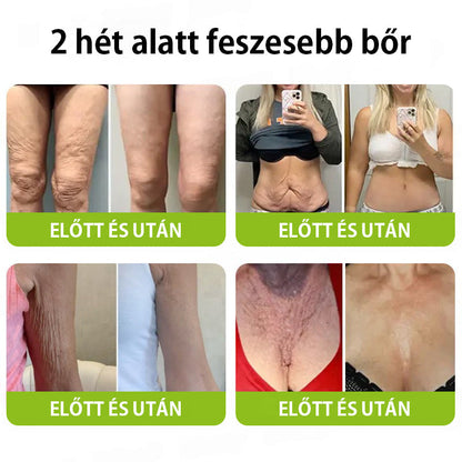 ✨ Vosxu™ Botox & Vita-A Retinol Shot ráncfelvarró szérum ✨ – 💉 Mikro-tűk | 💪 Botox-szerű peptidek | 🌿 Retinol | ⚡ Látható eredmények már 3 nap alatt 🌸