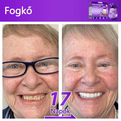 𝐷𝑜𝒓𝒎𝒐𝒓𝑛𝑎® Fogregeneráló és -javító por hidroxiapatittal 🦷 (hatékonyan javítja a fogszuvasodást, az ínyproblémákat, a fogak túlérzékenységét, a szájfekélyeket és a fogak sárgulását, átfogóan javítva a szájhigiéniát) 🍀