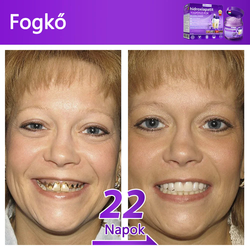 𝐷𝑜𝒓𝒎𝒐𝒓𝑛𝑎® Fogregeneráló és -javító por hidroxiapatittal 🦷 (hatékonyan javítja a fogszuvasodást, az ínyproblémákat, a fogak túlérzékenységét, a szájfekélyeket és a fogak sárgulását, átfogóan javítva a szájhigiéniát) 🍀