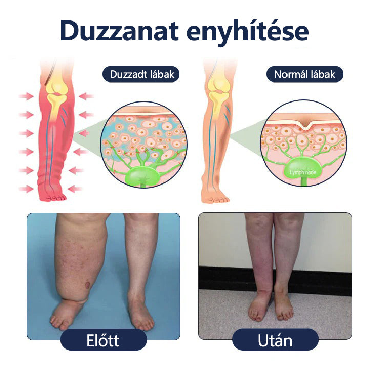 Tivora®✨ SwellRelief keringést támogató krém