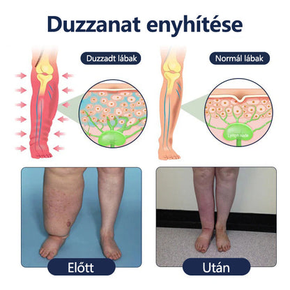 Tivora®✨ SwellRelief keringést támogató krém