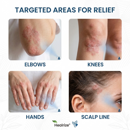 🔥Healrize® Magnesium Botanic Spray – Advanced Skin Recovery for Psoriasis & Eczema | Rapid Soothing, Steroid-Free
