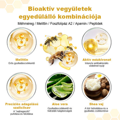 🐝 Auralithe® PsoriaSoothe – Szteroidmentes méhméreges krém viszkető, hámló és érzékeny bőrre ⭐⭐