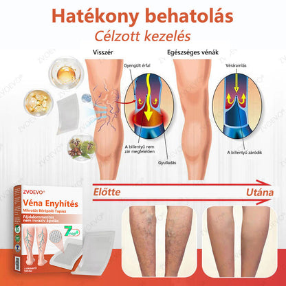 🌈 Zvoevo® Vein Ease mikro-tűs ápoló tapasz (pókgerincvénák, visszér, duzzanat, fáradt lábak kezelésére)