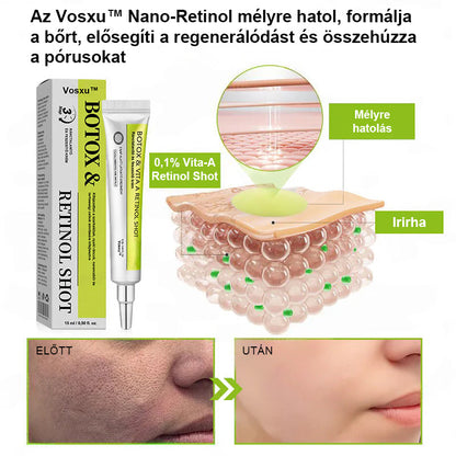 ✨ Vosxu™ Botox & Vita-A Retinol Shot ráncfelvarró szérum ✨ – 💉 Mikro-tűk | 💪 Botox-szerű peptidek | 🌿 Retinol | ⚡ Látható eredmények már 3 nap alatt 🌸