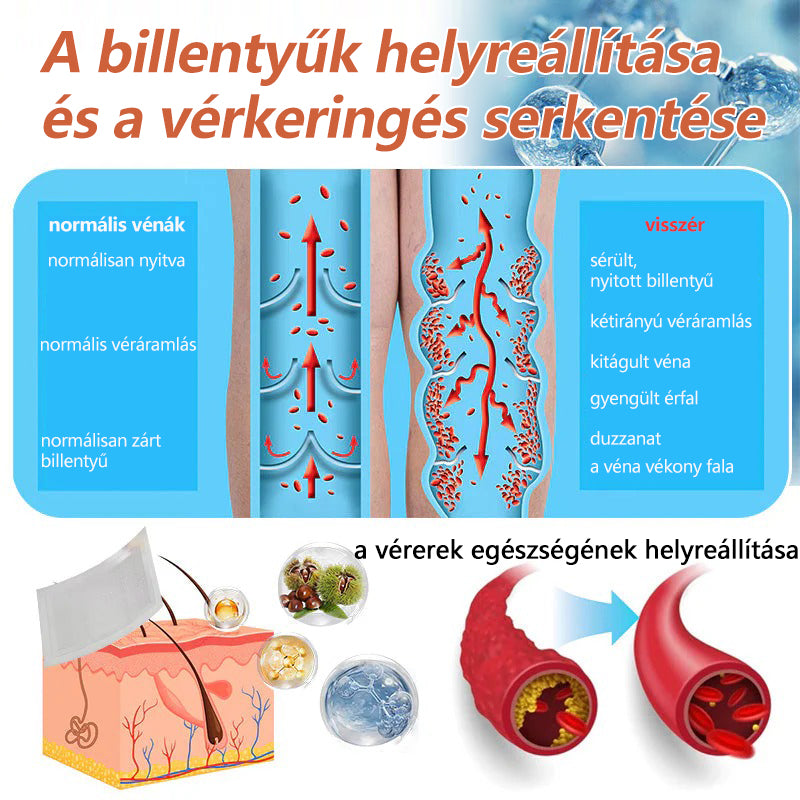 🔥 Zvoevo® Vein Ease mikro-tűs ápoló tapasz (pókgerincvénák, visszér, duzzanat, fáradt lábak kezelésére)