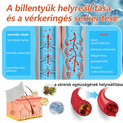 🌈 Zvoevo® Vein Ease mikro-tűs ápoló tapasz (pókgerincvénák, visszér, duzzanat, fáradt lábak kezelésére)