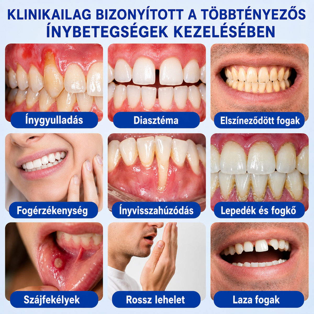 👨‍⚕️🦷✨Evolvion® GumRevive fogágyregeneráló gél